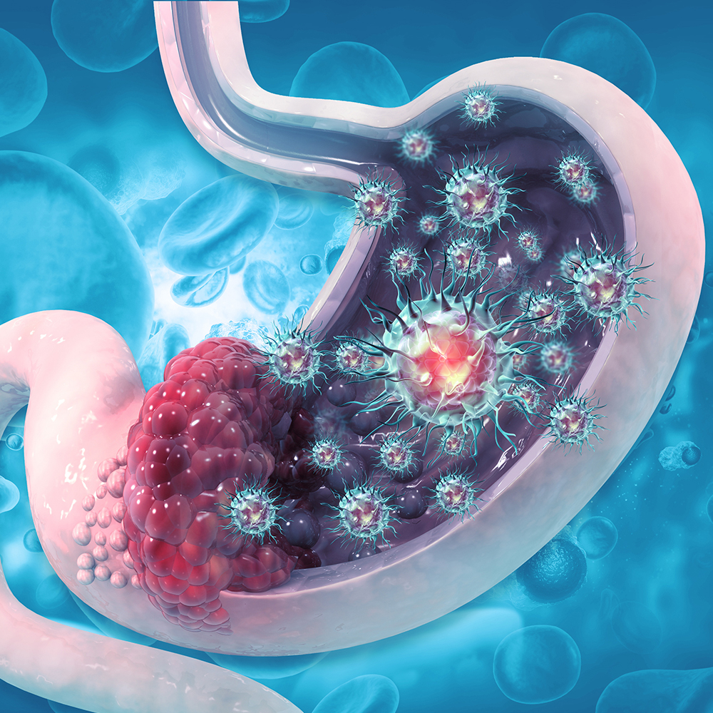 Gastric and Gastroesophageal Cancers: Navigating the Evolving Treatment Landscape to Optimize Care and Advance Health Equity