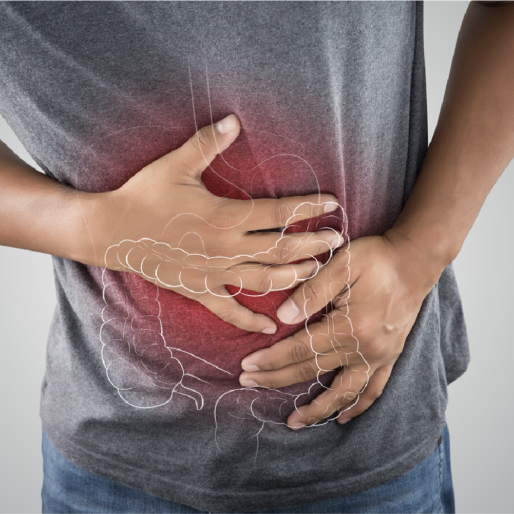 Linking Experts and Primary Care Clinicians to Improve IBD Recognition and Management in Rural and Underserved Communities – Lessons Learned